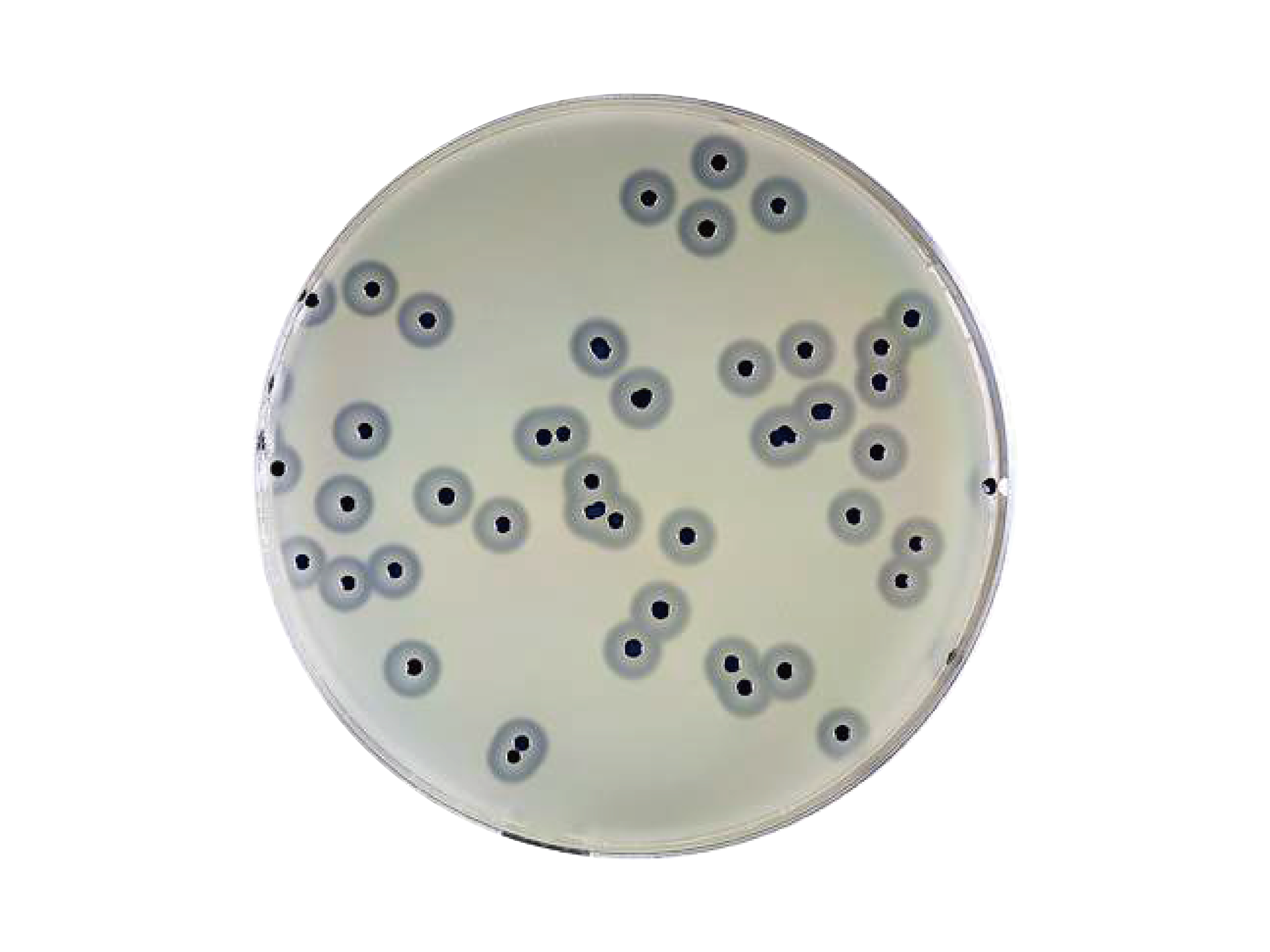 Baird Parker Agar